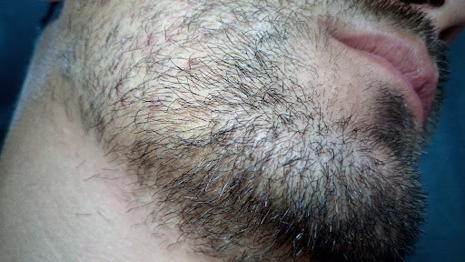 How to Grow a Beard In 3 Weeks