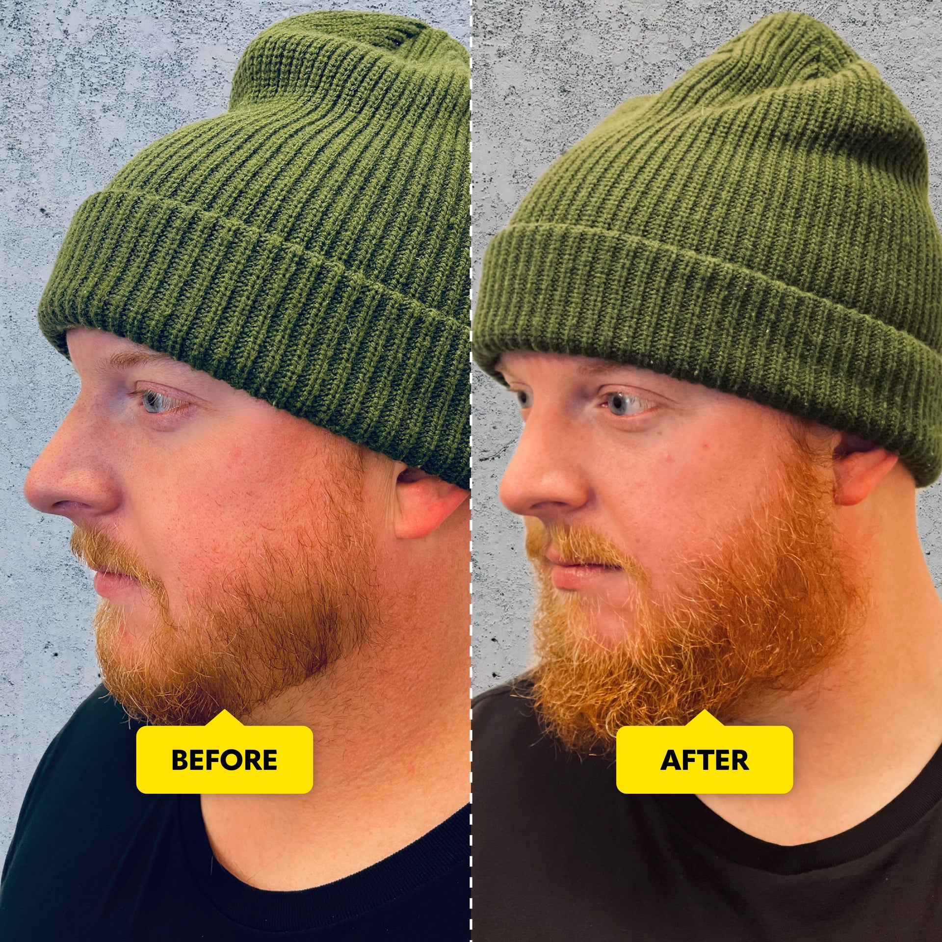 Beard Growth Balm