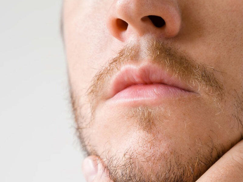 Patchy Beard?