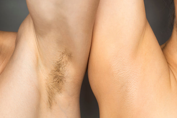 Should Men Shave Their Armpits? How to Trim Safely, If You Decide