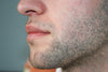 Why Can I Only Grow a Neckbeard? 8 Things To Know