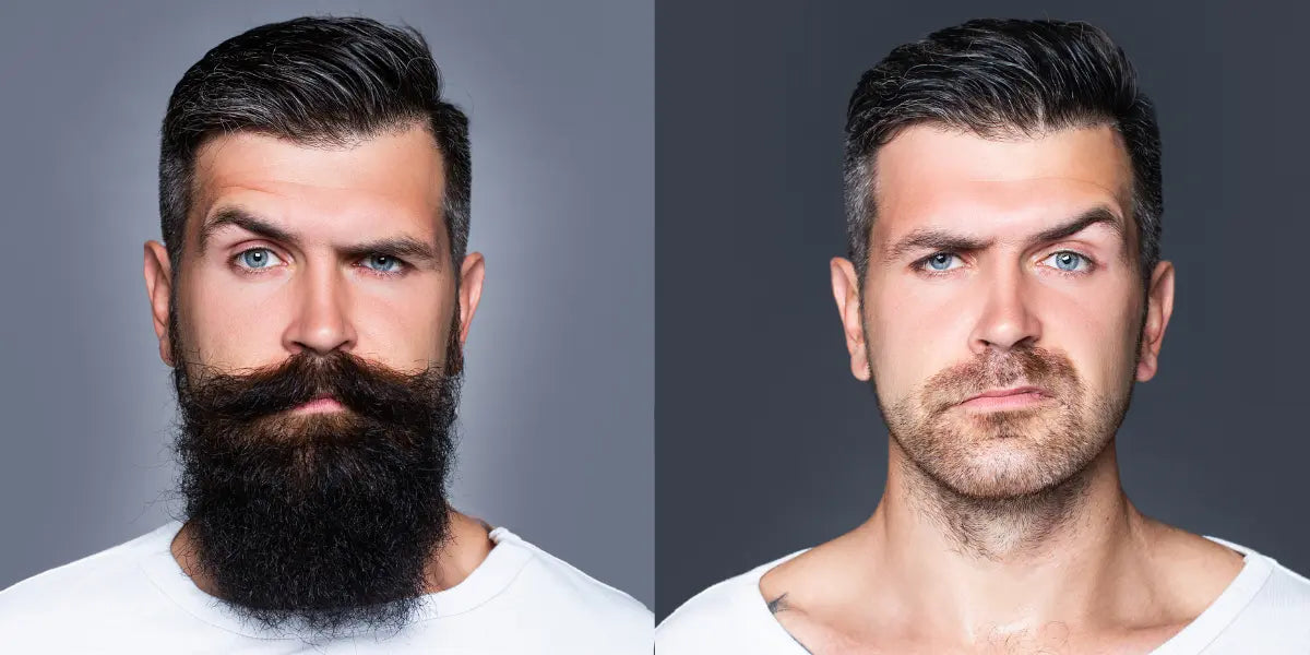 The Best Beard Styles for Round Faces (And Which to Avoid)