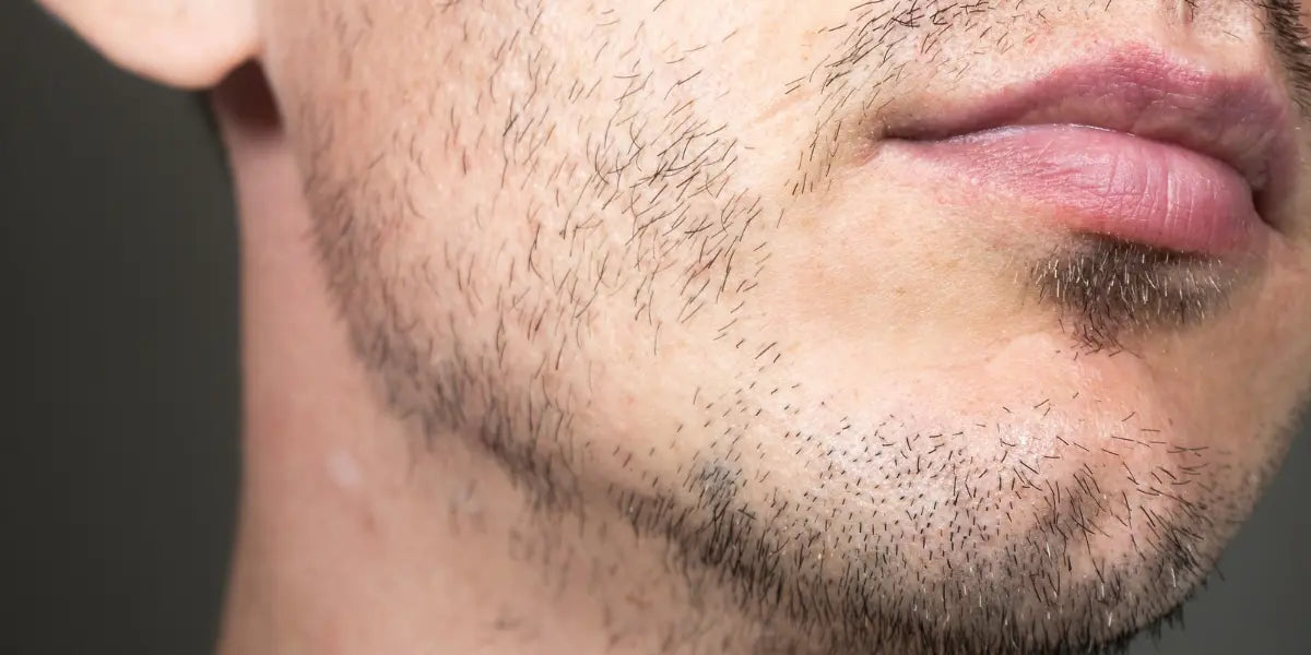 Minoxidil vs. Beard Oil: What Do You Need for a Patchy Beard?