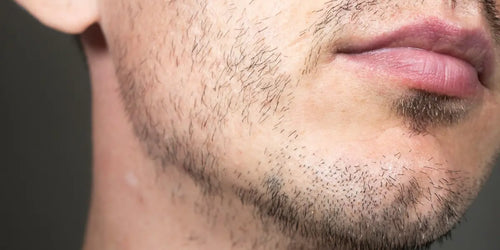 Minoxidil vs. Beard Oil: What Do You Need for a Patchy Beard?