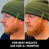 Advanced Beard Growth Kit