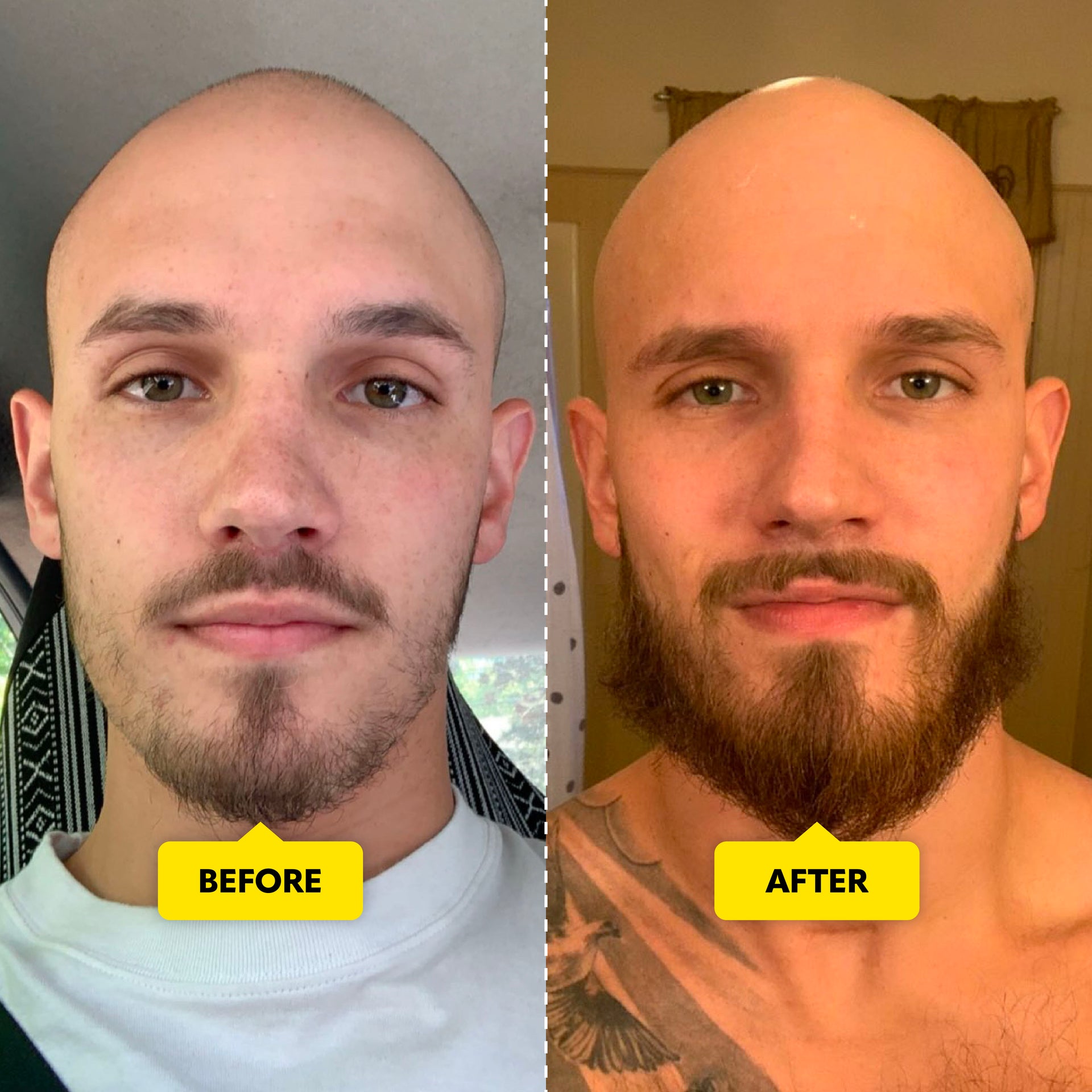 Beard Growth Oil for Facial Hair | The Beard Club