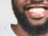 Luscious Beard?