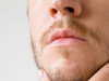 Patchy Beard?